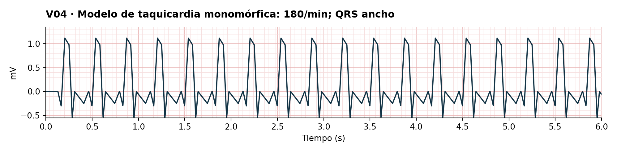 V04 · Modelo de taquicardia monomórfica: 180/min; QRS ancho