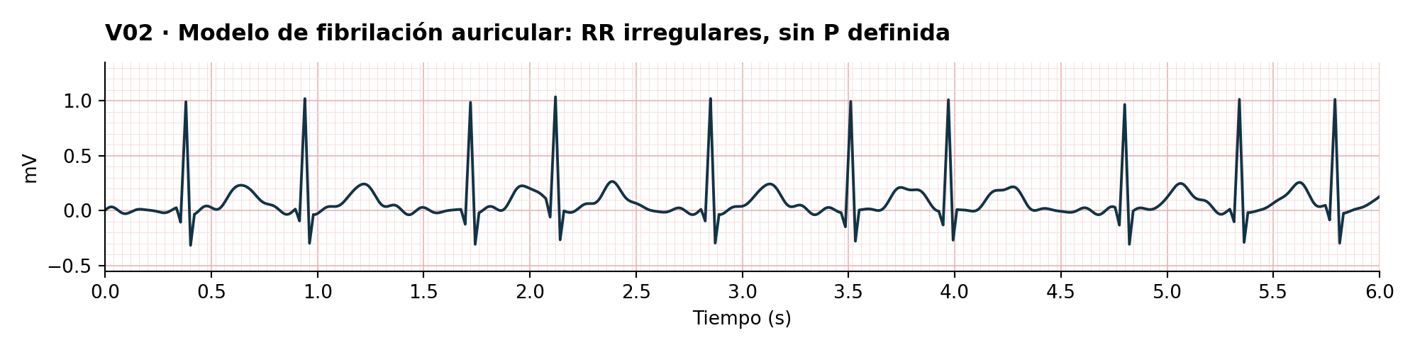V02 · Modelo de fibrilación auricular: RR irregulares, sin P definida