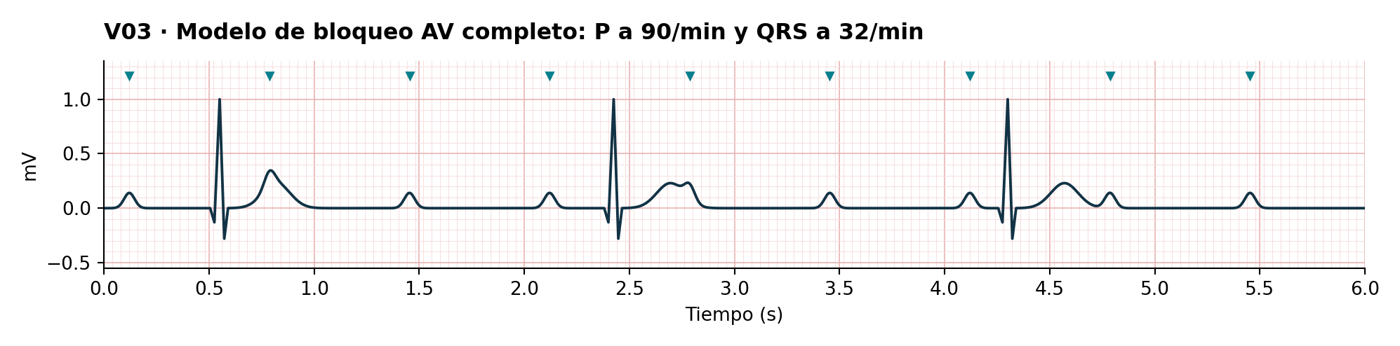 V03 · Modelo de bloqueo AV completo: P a 90/min y QRS a 32/min